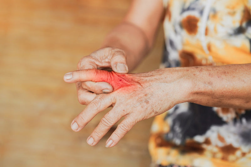 Ich dachte, es wären einfach nur Alterserscheinungen – …bis mir eine Frau in der Reha erklärte, was wirklich hinter meiner Arthrose in den Fingern steckt