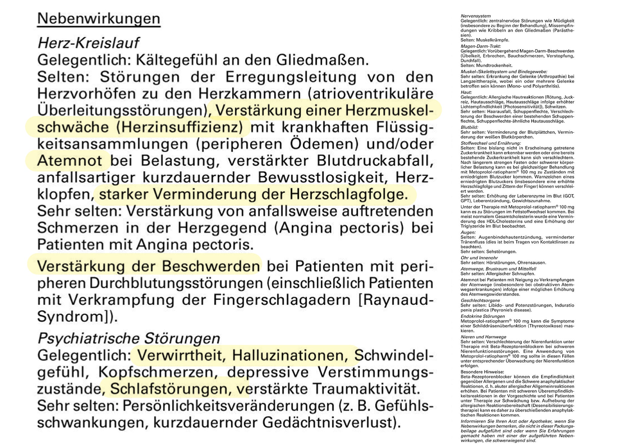 Betablocker Nebenwirkungen