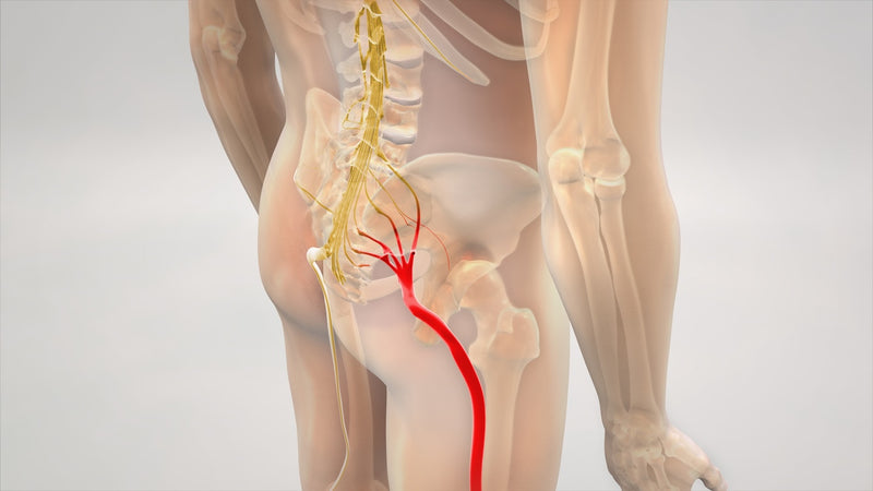 Neuro ischias anatomisch