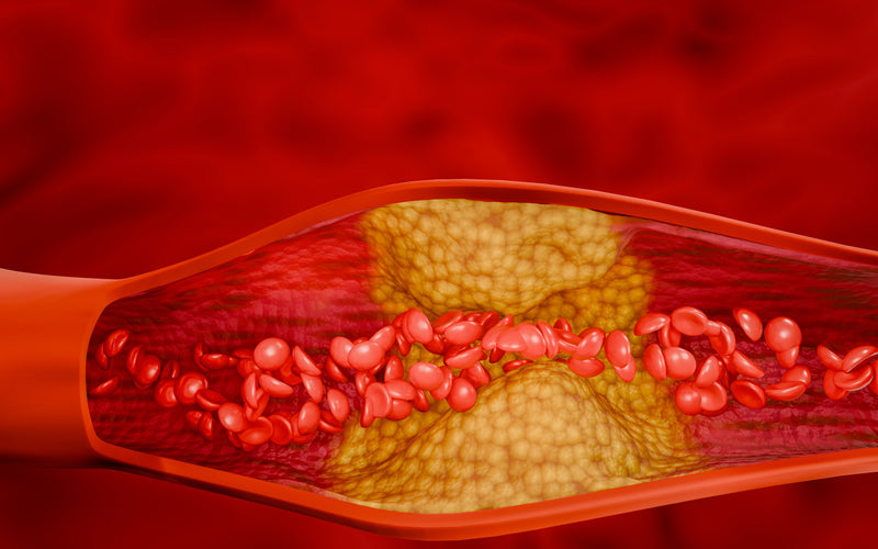 Schwarzkuemmeloel bluthochdruck arterie 1